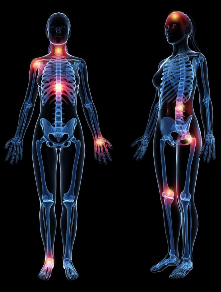 Bodies with Pain