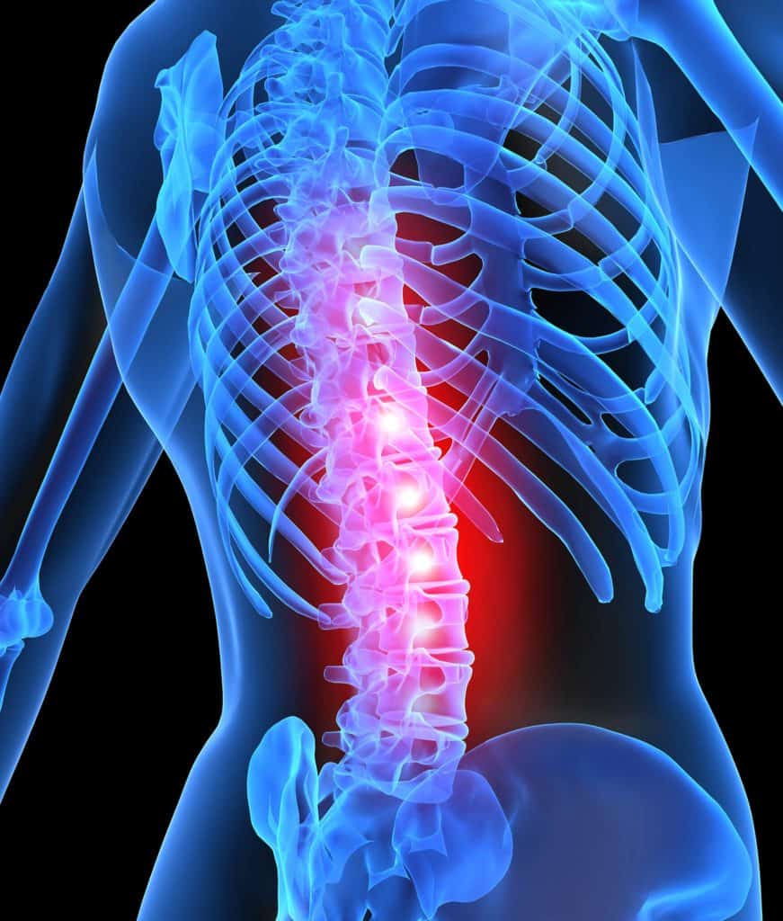 Back Pain