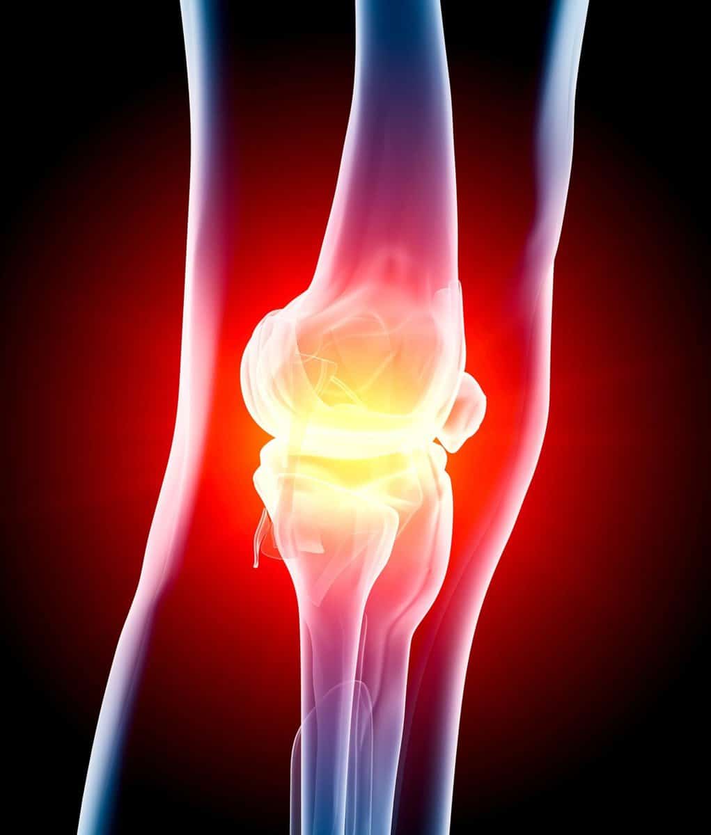 Knee Pain