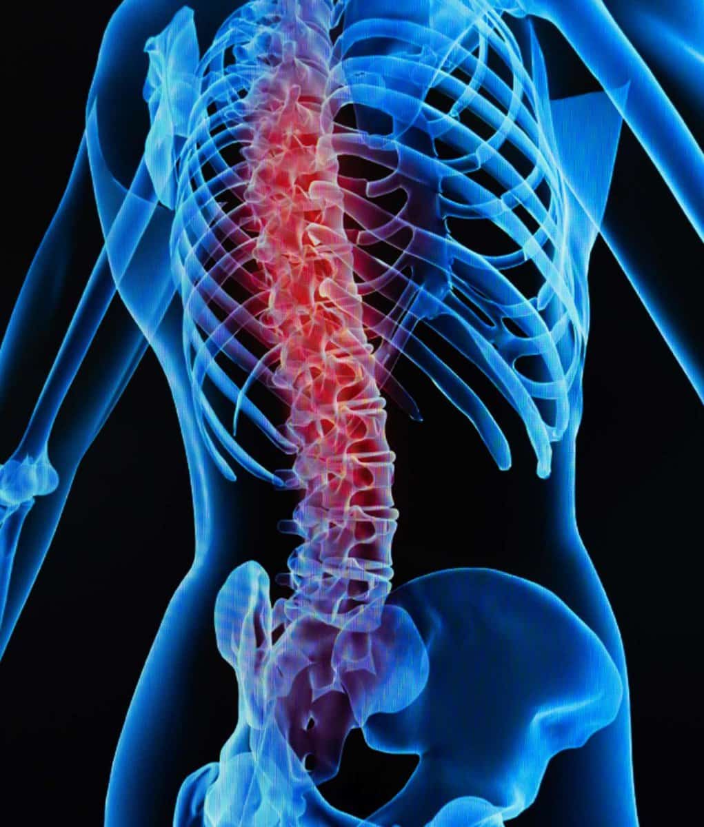 Thoracic Pain