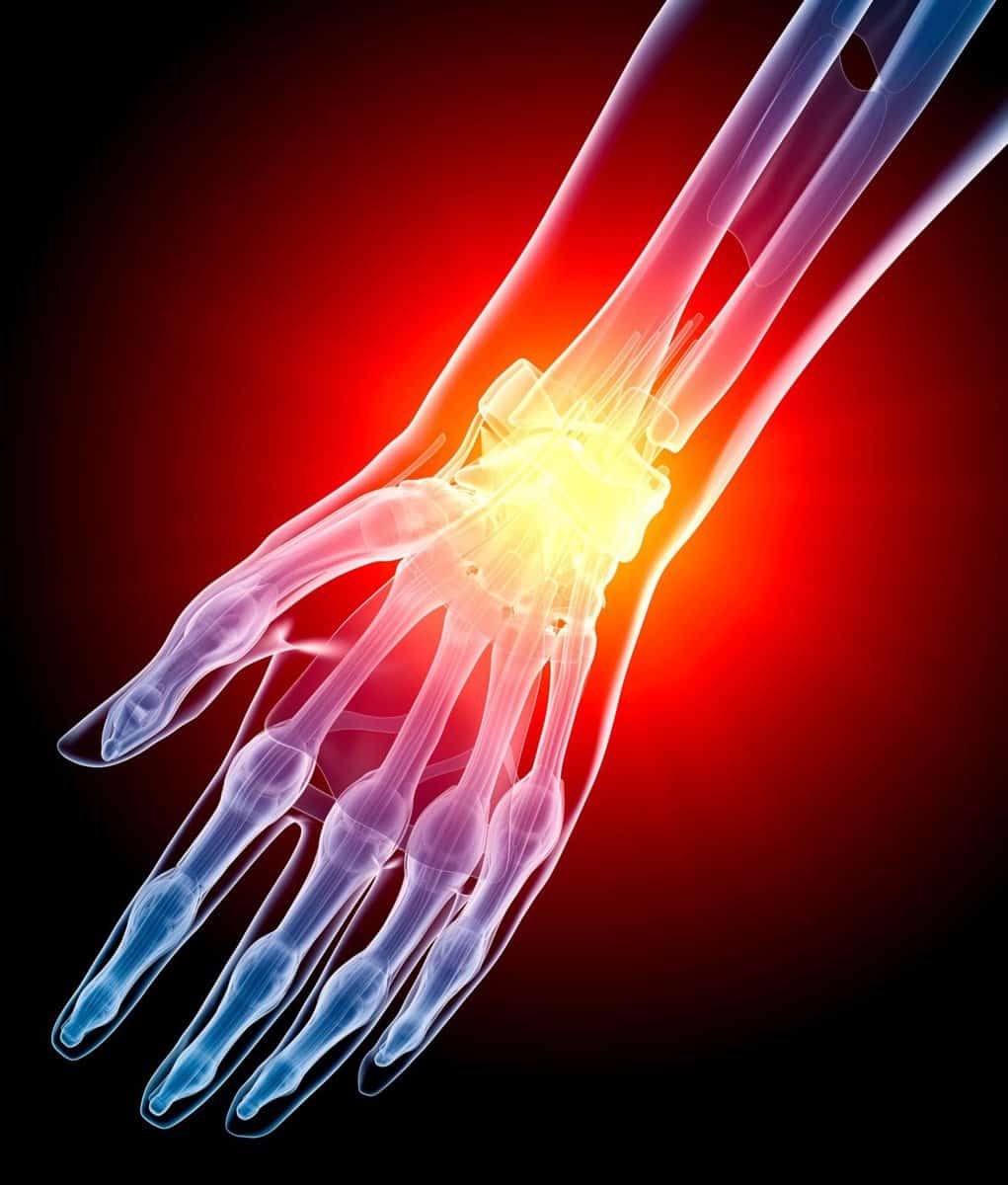 Wrist Pain